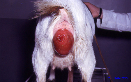 Prolapsus vaginal (Cr&eacute;dit et copyright C FRANCOI
